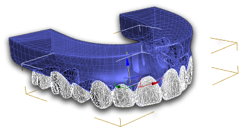 3D Smile Design
